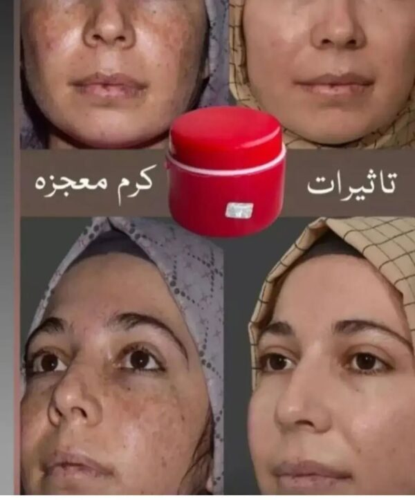 تاثیر کرم معجزه