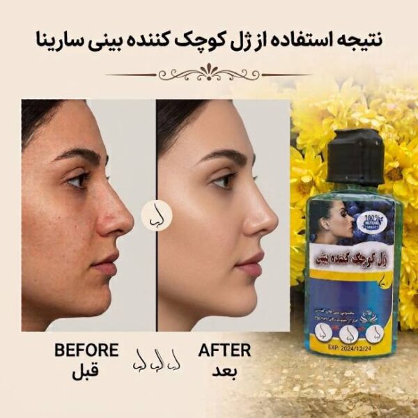 ژل کوچک کننده بینی