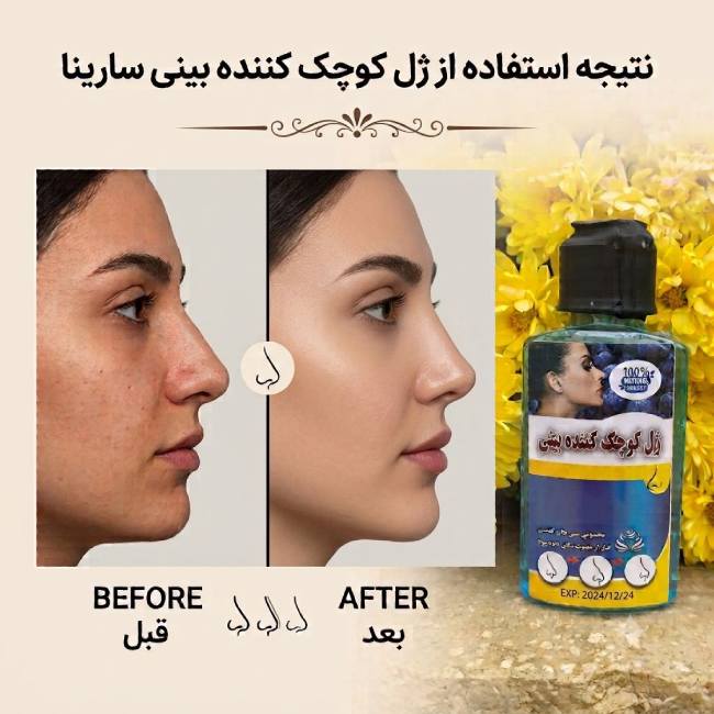ژل-کوچک-کننده-بینی ژل کوچک کننده بینی