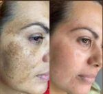 کرم شاین طلایی بهترین ضد لک و روشن کننده صورت - Image 2