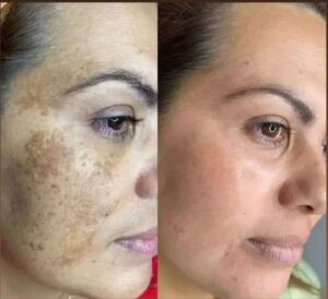 قیمت کرم گلدن شاین